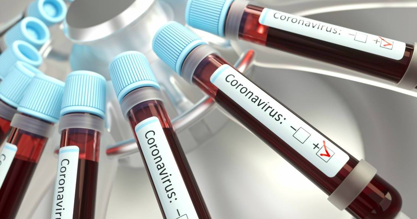 Todos os laboratórios públicos do país podem realizar exame para coronavírus