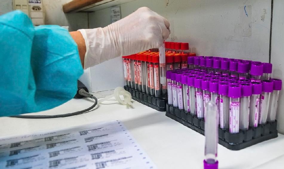 Mais dois laboratórios realizam exame sorológico para Covid-19 pelo Mato Grosso Saúde