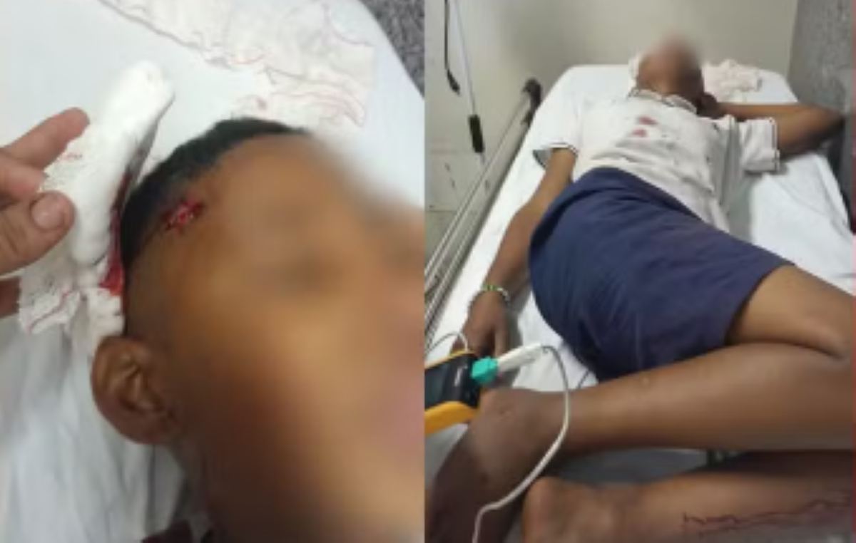 Menino de 11 anos tem crânio rachado após ser agredido com paulada em escola